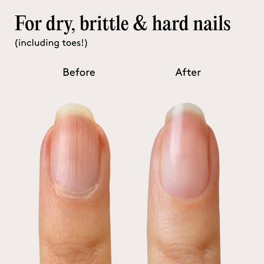 Sérum Booster Protecteur Ongles - Mylee